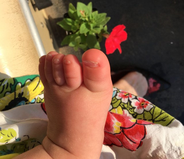 Little Man's foot during Stanley's adventure - 7-26-2018